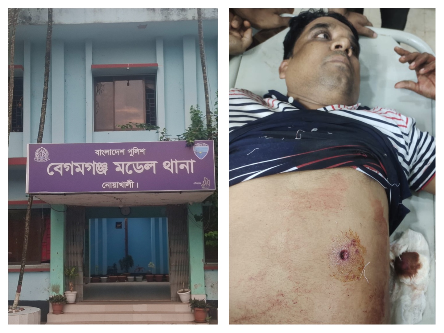 নোয়াখালীতে বিএনপি নেতাকে গুলি, লাগল সহযোগীর বুকে