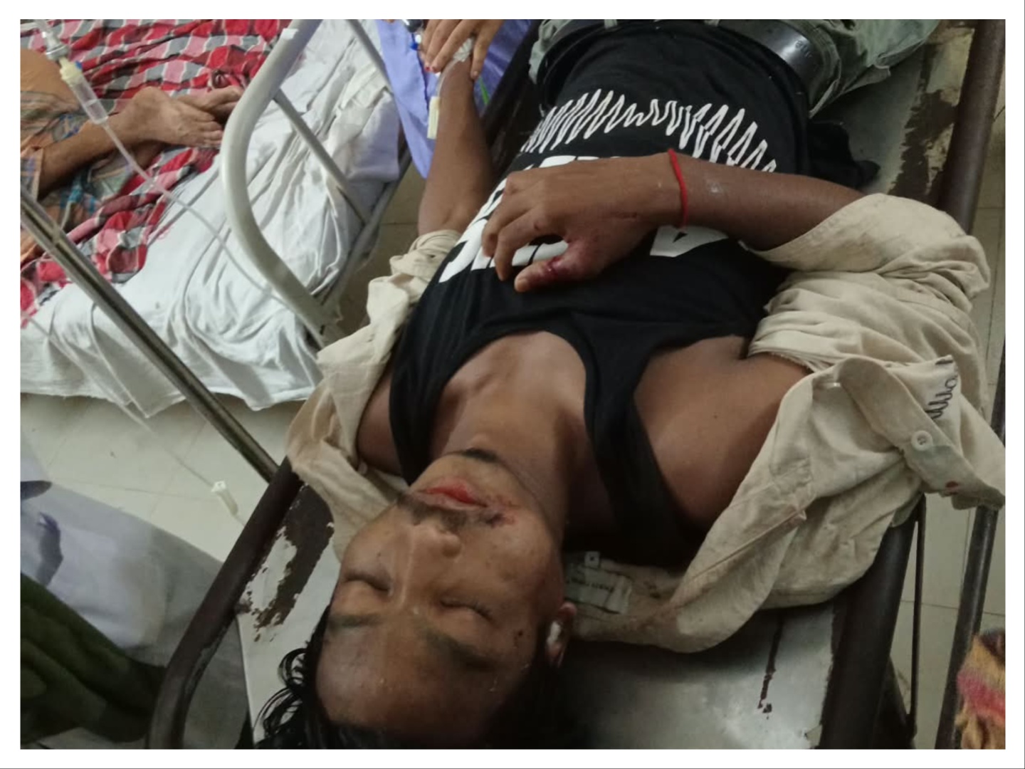 রুহিয়ায় সড়ক দুর্ঘটনায় যুবক নিহত, আহত ২