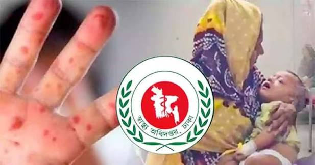 হাম উপসর্গে আরও ৭ শিশুর মৃত্যু, নতুন আক্রান্ত ৮৫৫