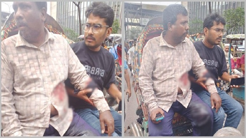 মতিঝিলে ব্যবসায়ীকে গুলি করে ১৭ হাজার ডলার লুট
