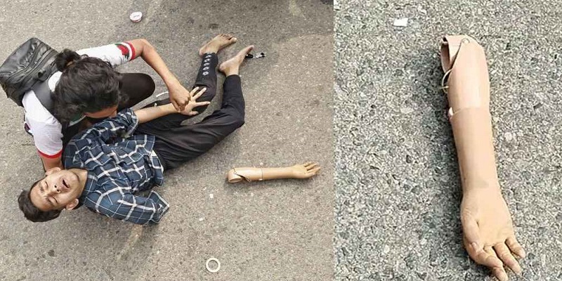 পুলিশের লাঠিচার্জ: রাস্তায় পড়ে ছিল জুলাই যোদ্ধার কৃত্রিম হাত