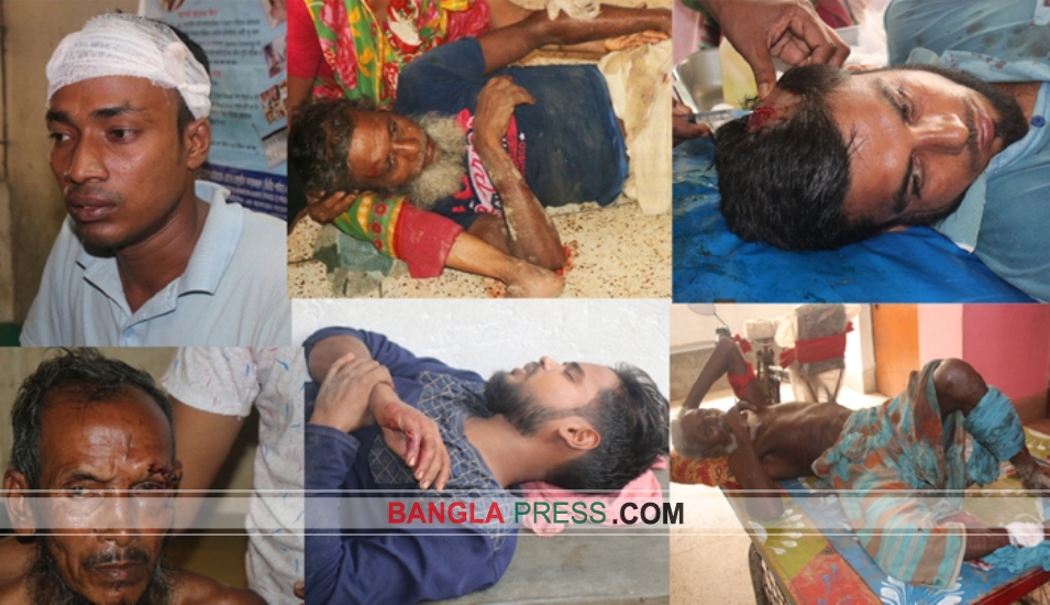 বোয়ালমারীতে আধিপত্য বিস্তারকে কেন্দ্র করে সংঘর্ষে আহত ৩০