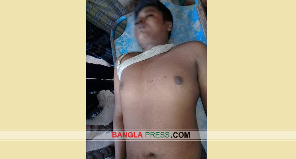 শৈলকুপায় বিদ্যুৎস্পৃষ্টে কলেজছাত্রের মৃত্যু