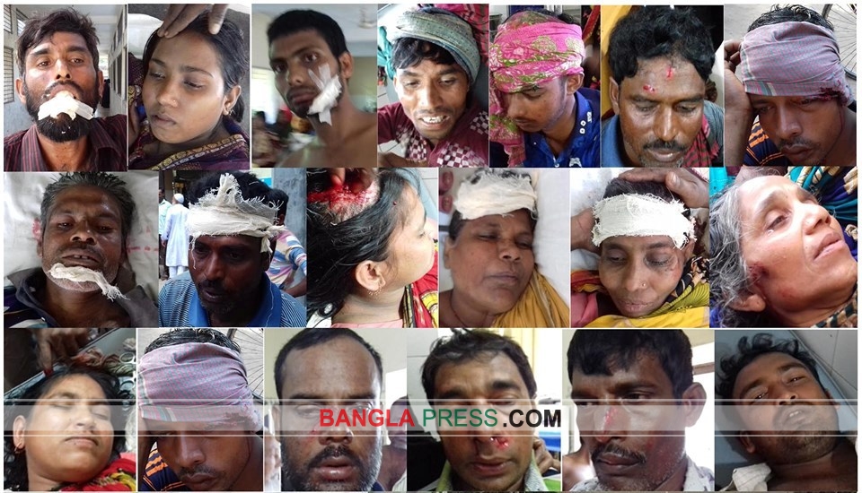 শৈলকুপায় দু’দল গ্রামবাসীর মধ্যে সংঘর্ষে আহত অর্ধশতাধিক