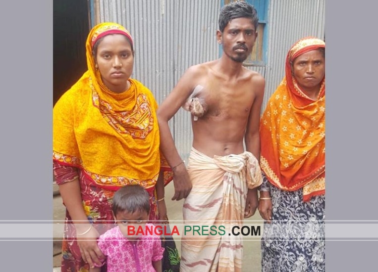 চিকিৎসার অভাবে কাতরাচ্ছেন ভোগডাঙ্গার দিনমজুর আমজাদ