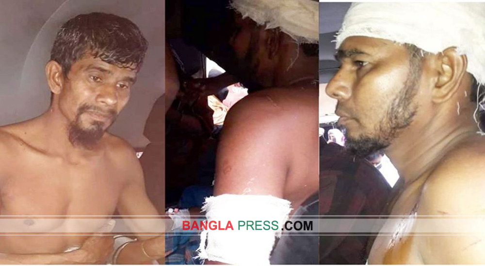 মোবাইল রিচার্জ নিয়ে শৈলকুপায় সংঘর্ষে মহিলাসহ আহত ৪