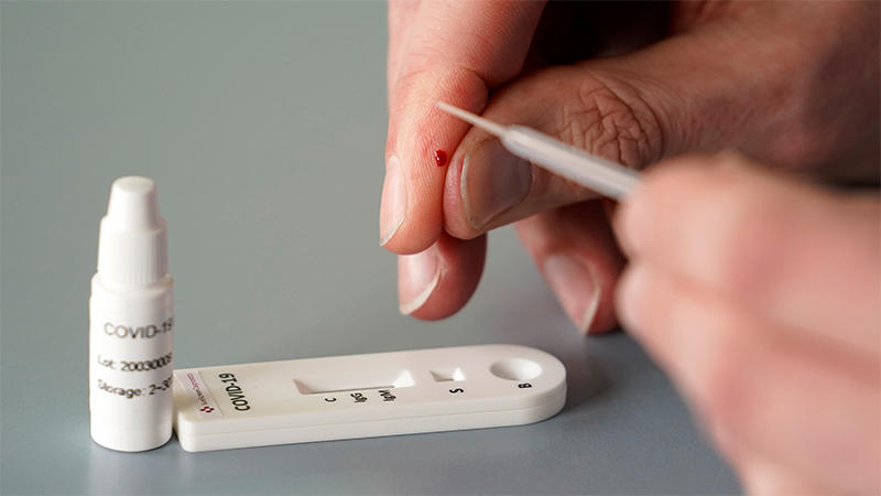 অবশেষে গণস্বাস্থ্য কেন্দ্রের কিট অনুমোদন দিলো ওষুধ প্রশাসন