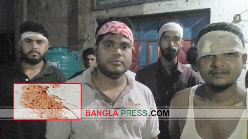 সৈয়দপুরে পানের পিক ফেলাকে কেন্দ্র করে সংঘর্ষে আহত ৩০