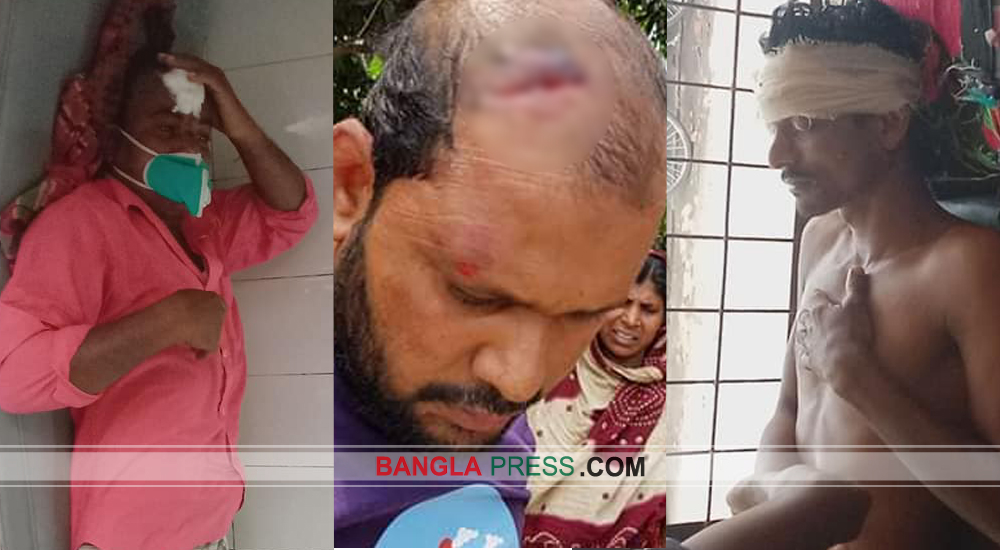 ত্রাণ দেয়াকে কেন্দ্র করে আ’লীগের দু’গ্রুপের সংঘর্ষে ১৫ জন আহত