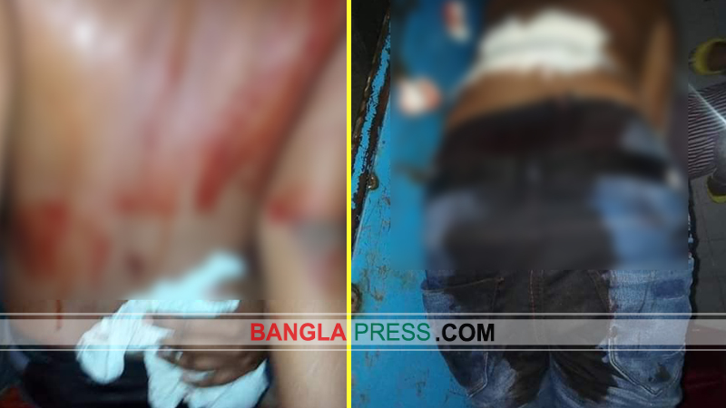 সৈয়দপুরে যুবককে কুপিয়ে হত্যার চেষ্টা
