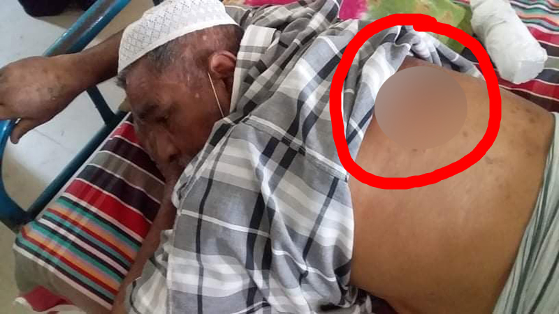 ঈশ্বরদীতে দলীয় কর্মীর হামলায় আওয়ামীলীগ নেতা আহত