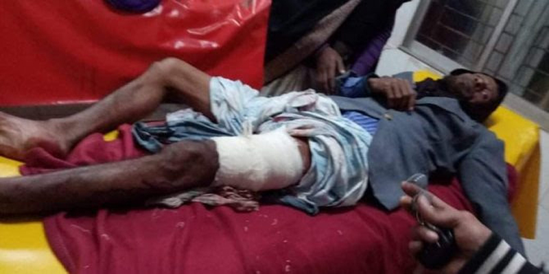 লক্ষ্মীপুরে নৌকা প্রার্থীর কর্মীকে কুপিয়ে জখম