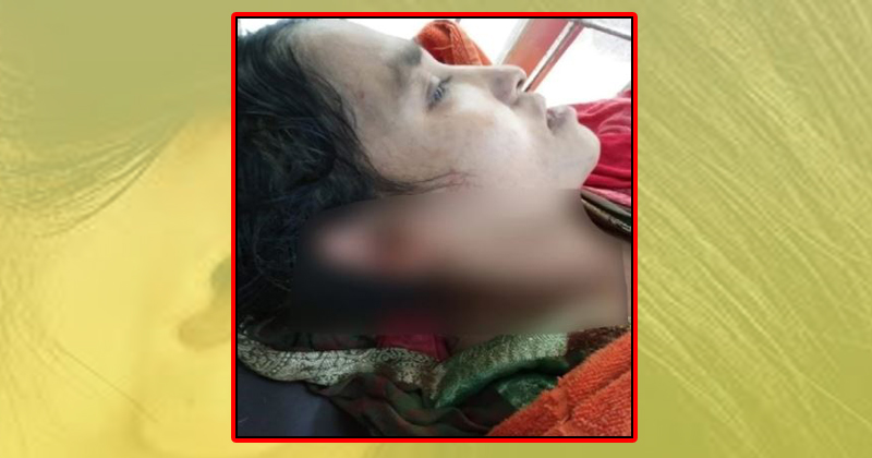 বিজয়ী প্রার্থীর কান ছিঁড়ে দিয়েছে পরাজিত প্রার্থী