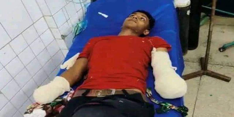 পলাশে পরকীয়ার জেরে এক যুবকের দুই হাতের কব্জি কর্তন