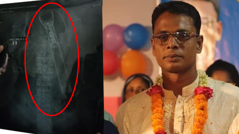 আ.লীগ নেতার ইন্ধনে বৃদ্ধের পায়ু পথে টর্চলাইট ঢুকিয়ে নির্যাতন