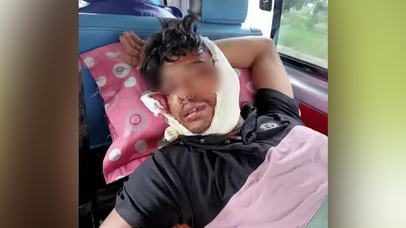 কারাগারে ঘুমন্ত হাজতির দুচোখ নষ্ট করলো কয়েদী