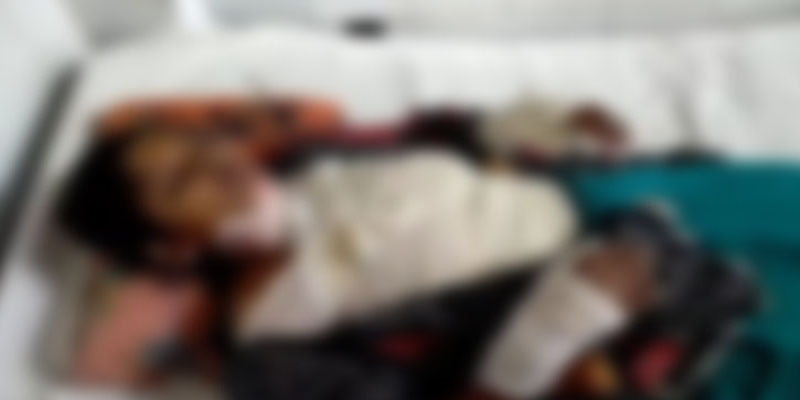 যৌতুকের জন্য গৃহবধূর শরীরে কেরোসিন ঢেলে পুড়িয়ে হত্যার চেষ্টা